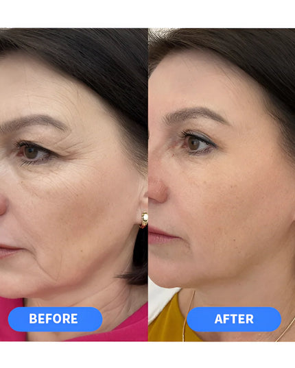 A313 Retinol Cream 50g French Pharmacy