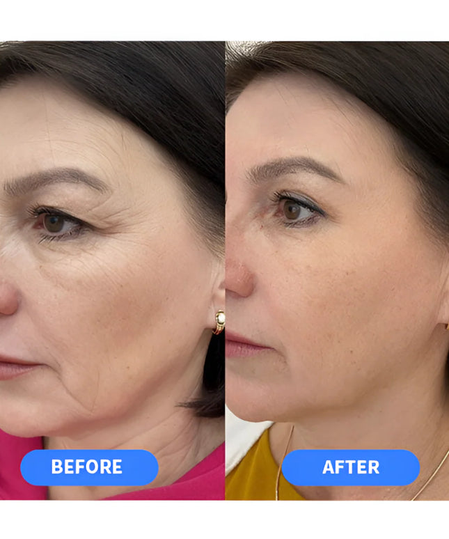 A313 Retinol Cream 50g French Pharmacy