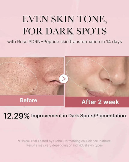 PDRN Pink Niacinamide Milky Toner